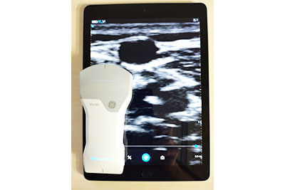 ポータブル超音波検査装置